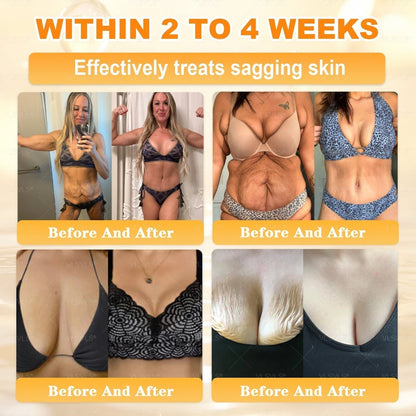 🔥 LAST DAY 80% OFF🔥 Aeehfeng® Bee Venom Skin Restoration Cream