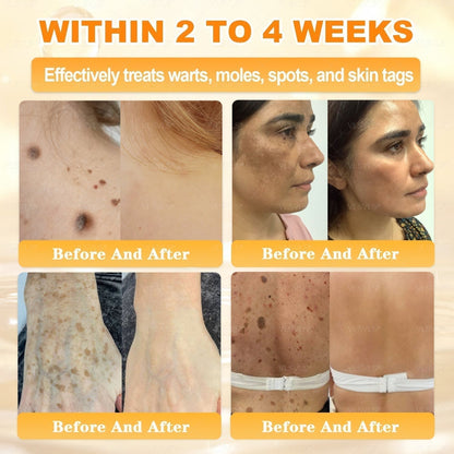 🔥 LAST DAY 80% OFF🔥 Aeehfeng® Bee Venom Skin Restoration Cream